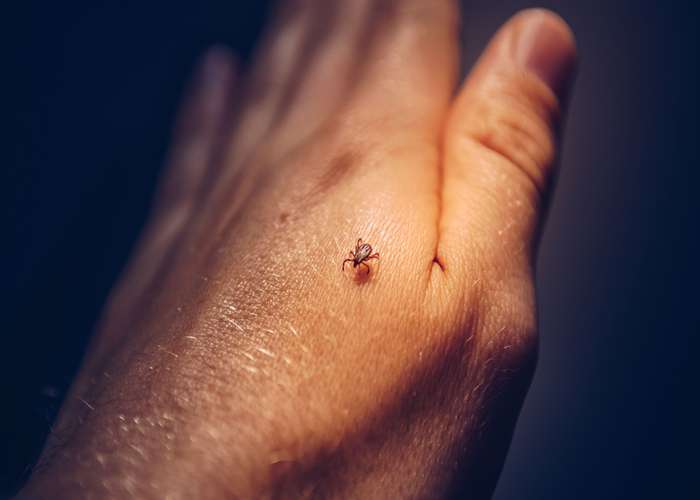 Remove the tick immediately to avoid Lyme disease